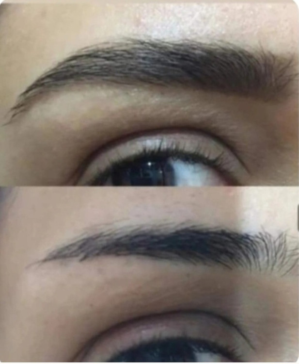 نتیجه استفاده دوماه از روغن تقویت کننده مژه وابرو