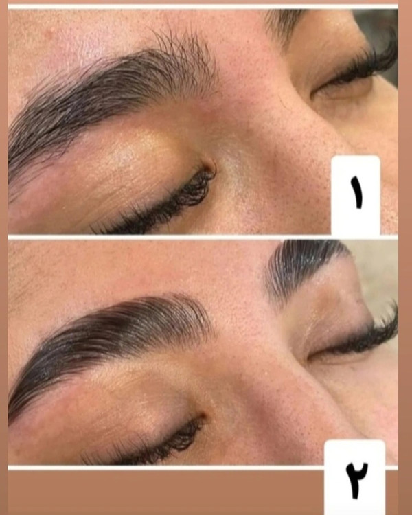 نتیجه استفاده از ژل لیفت، داشتن ابروهای مرتب وپرپشت