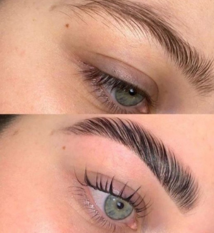 لیفت کننده قوی ابرو ها